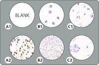 5-Core BRAF V600E Cell Line Microarray MAIN