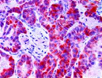 braf v600e anti-braf v600e braf-v600e antibody immunohistochemistry ihc anti-braf MAIN