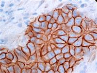 Beta-Catenin (14), MMab MAIN