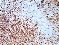 CTNNB1, sc7963, β-catenin, b-catenin, b catenin, beta catenin, beta-catenin, sc-7963, 7963, β catenin, βcatenin, anti-β- MAIN