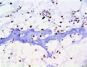 Brachyury (RBT-TBXT), RMab MAIN