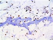 Brachyury (RBT-TBXT), RMab THUMBNAIL