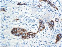 CA15-3 (DF3), MMab MAIN