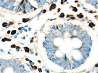 CA19-9 (121SLE), MMab MAIN