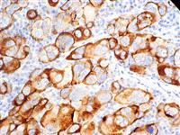 CA-125 (EP48), RMab MAIN