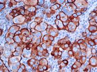 CA-125 (OC125), MMab MAIN