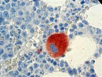 CD61 (2f2), MMab MAIN