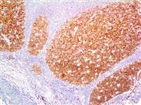 CD10 (56C6), MMab MAIN