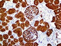 CD10 (EP195), RMab MAIN