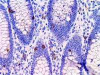 CD103 / ITGAE (EP206), RMab MAIN