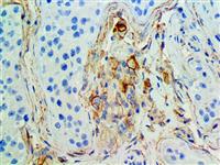 CD105 / Endoglin (EP274), RMab MAIN