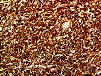 c Kit, CD117, Kit, cKit, anti c Kit, anti c-Kit, anti CD117, anti cKit, anti-c Kit, anti-c-Kit, anti-CD117, anti-cKit MAIN