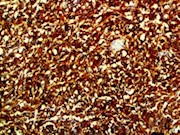 c Kit, CD117, Kit, cKit, anti c Kit, anti c-Kit, anti CD117, anti cKit, anti-c Kit, anti-c-Kit, anti-CD117, anti-cKit THUMBNAIL