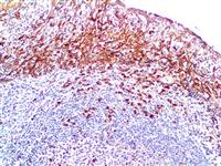 CD138 (EP201), RMab MAIN