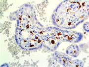 CD14 (7), MMab THUMBNAIL