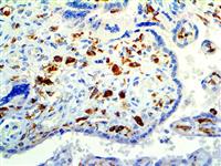 CD14 (EP128), RMab MAIN