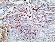 cd147, cd-147 cd 147, anti-cd147, anti-cd-147, cd147 antibody, anti-cd147 antibody, sars-cov-2 receptors, sars cov-2 rec THUMBNAIL