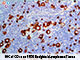 CD15 (BSB-119), MMab SWATCH