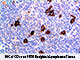 CD15 (BSB-119), MMab SWATCH