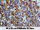 CD15 (BSB-119), MMab SWATCH