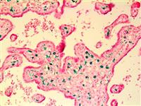 CD163 (10D6), MMab MAIN