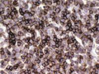 CD1a (EP80), RMab MAIN