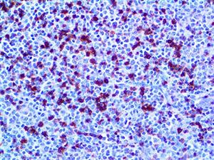 CD2 (AB75), MMab MAIN