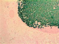 CD20 (L26), MMab MAIN