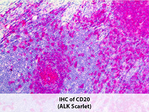 PolyDetector Alk Scarlet MAIN