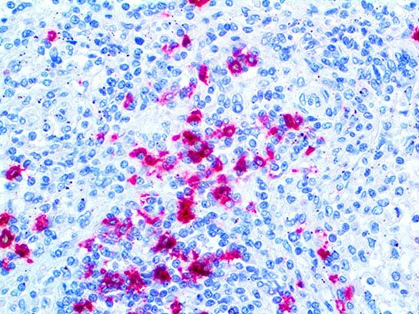 PolyDetector Alk Magenta THUMBNAIL