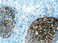 CD21 (EP64), RMab MAIN