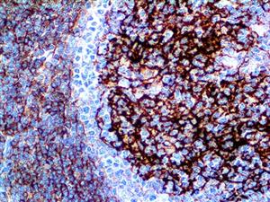 CD23 (1B12), MMab MAIN