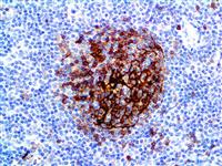 CD23 (EP75), RMab MAIN