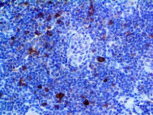 CD25 (RBT-CD25), RMab MAIN