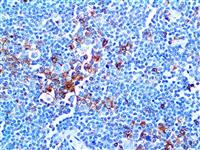 CD25 (4C9), MMab MAIN