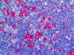 CD30 (Ber-H2), MMab MAIN