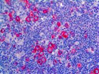 CD30 (Ber-H2), MMab MAIN