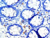 CD33 (RBT-CD33), RMab MAIN