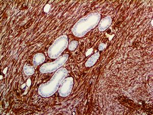 TintoFast CD34 (QBEnd/10), MMab MAIN
