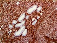 TintoFast CD34 (QBEnd/10), MMab MAIN
