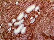 TintoFast CD34 (QBEnd/10), MMab THUMBNAIL