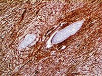 CD34 (QBEnd/10), MMab MAIN