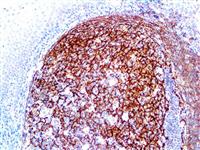 CD35 (RLB25), MMab MAIN