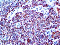 CD35 (EP197), RMab MAIN