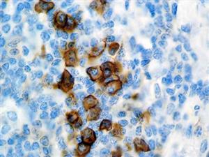 CD38 (SPC32), MMab MAIN