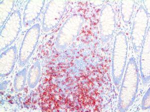 CD3 Epsilon (RBT-CD3e), RMab MAIN