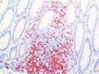 CD3 Epsilon (RBT-CD3e), RMab MAIN