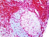 CD4 (RBT-CD4), RMab MAIN
