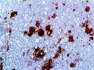 CD41 / Integrin alpha IIb (EP178), RMab MAIN