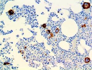 CD42b (EP409), RMab MAIN